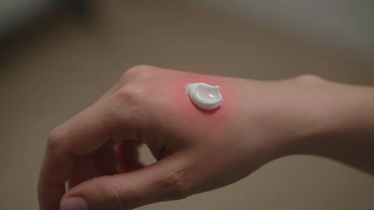 Test aplikace krému na vnitřní stranu zápěstí s mírným zarudnáním kůže.